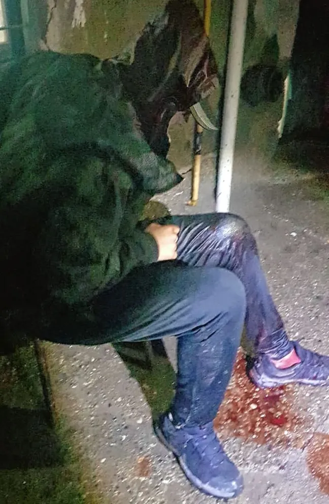 Le balearon las piernas a menor de 15 años en presunto “ajuste de cuentas”