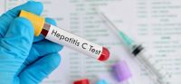 Hepatitis C: realizan test de detección gratuita en 70 hospitales de todo el país