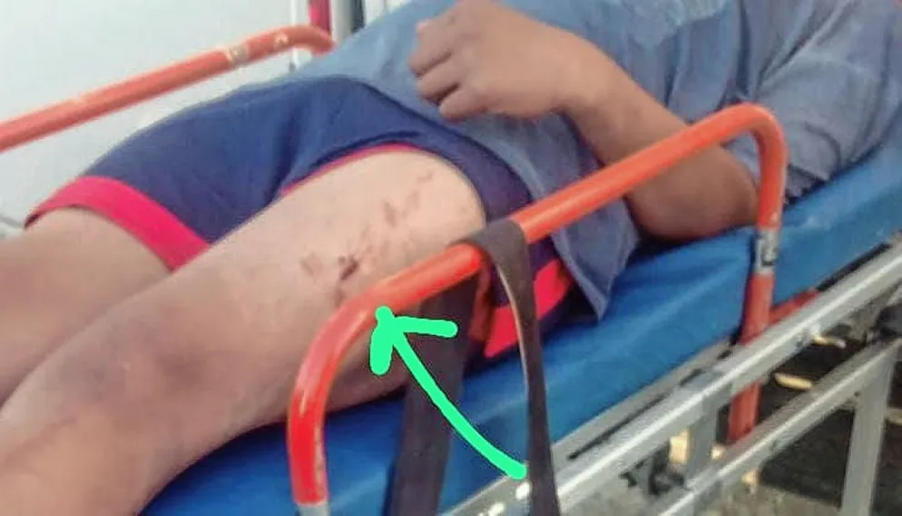 Adolescente golpeado y apuñalado en barrio San Martín por no llevar nada de valor; estuvo 14 horas sin asistencia médica