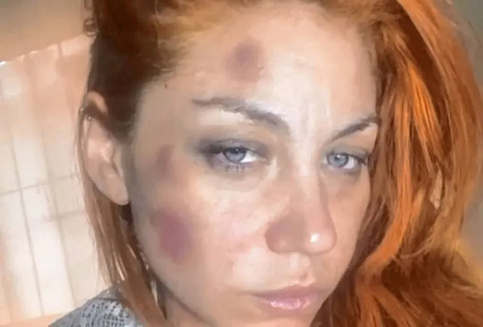 Lourdes, excantante de Bandana, denunció a su ex pareja por violencia de género