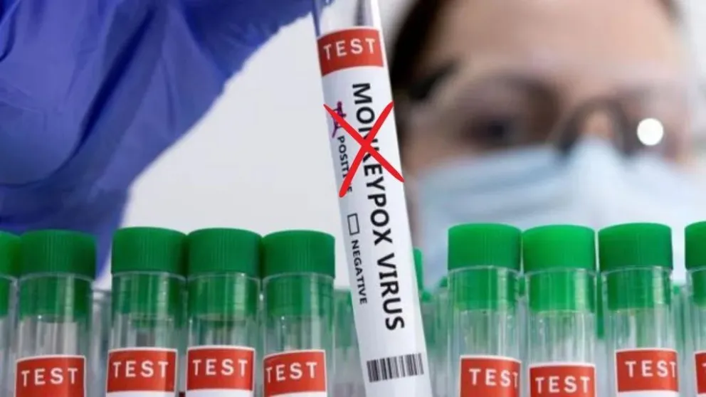 Cambiaron el nombre de la viruela del mono por Mpox debido al "lenguaje racista y estigmatizante"