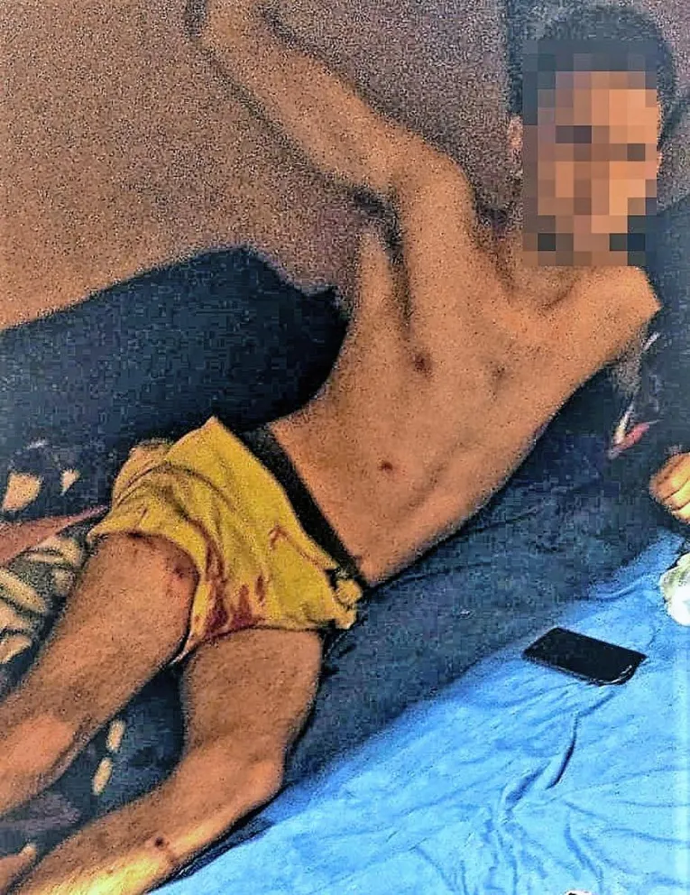 Toman por asalto una casa y hieren a tiros a uno de sus moradores
