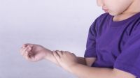 Claves para detectar artritis en niños y adolescentes