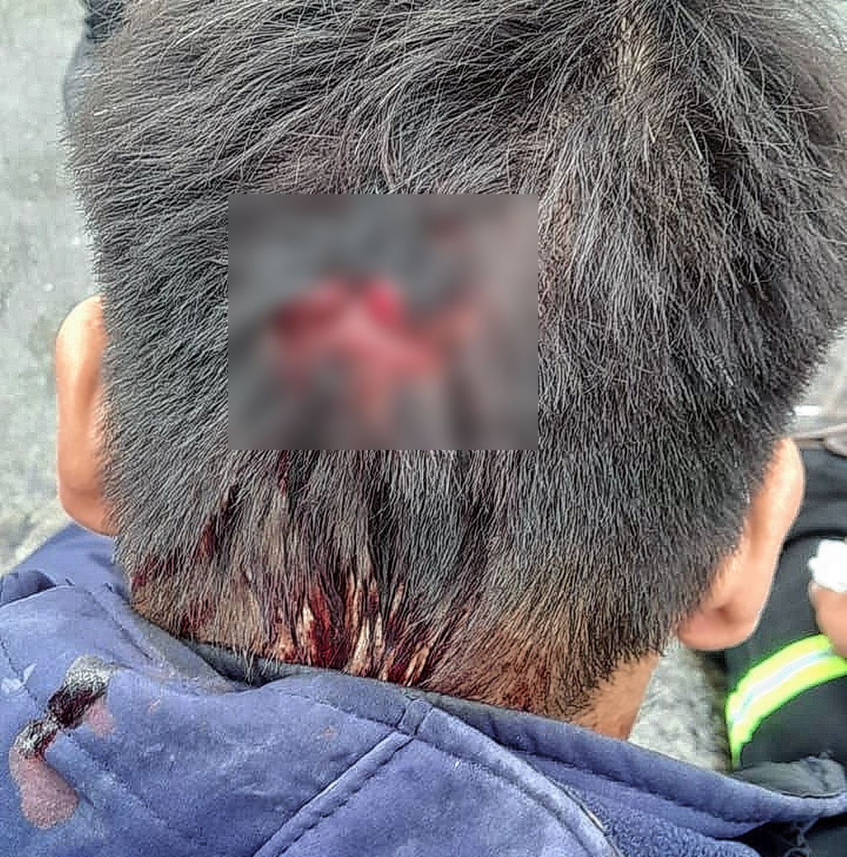 Empleado de una distribuidora de bebidas cayó de la caja de un camión y resultó lesionado