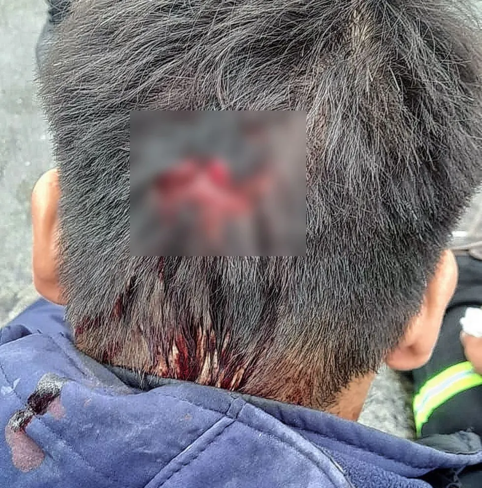 Empleado de una distribuidora de bebidas cayó de la caja de un camión y resultó lesionado