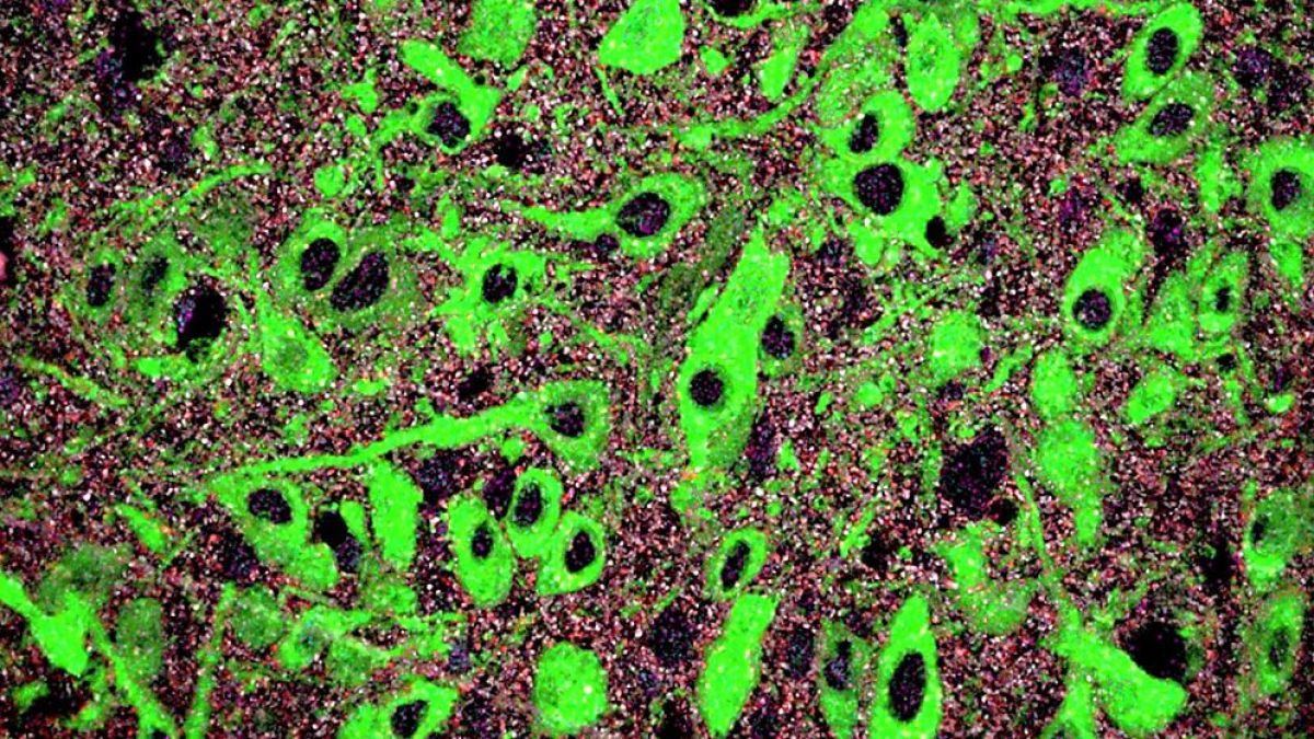 Identifican un mecanismo del neurodesarrollo cuya alteración contribuiría al origen de trastornos mentales como la depresión y la ansiedad