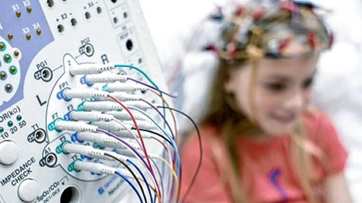 Realizarán una jornada de capacitación sobre epilepsia para profesionales de la salud y la comunidad en general