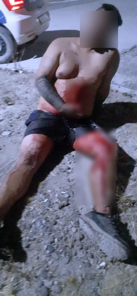 Sangrienta pelea en medio de una reunión familiar termina con un joven apuñalado por el hermano