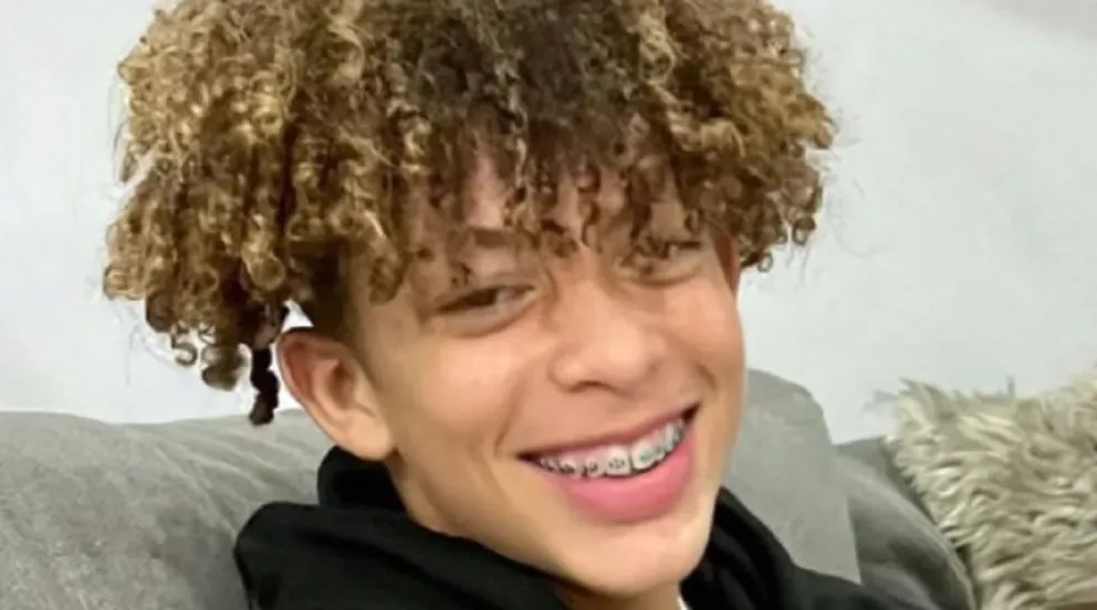 Un joven terminó con quemaduras en el 80% de su cuerpo por un desafío de TikTok