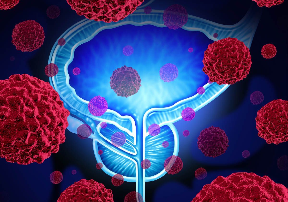 Mes de la concientización del cáncer de vejiga