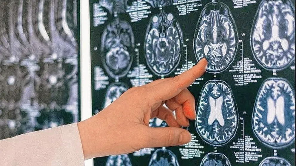 La Epilepsia: ¿Una enfermedad divina o maldita? 