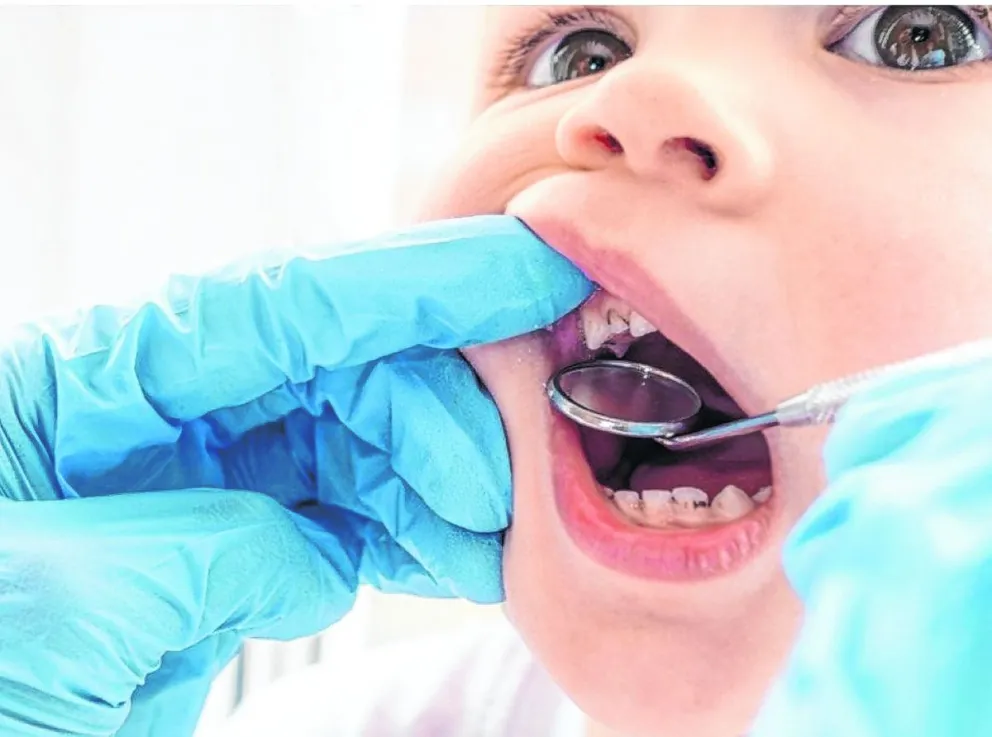 Caries en niños