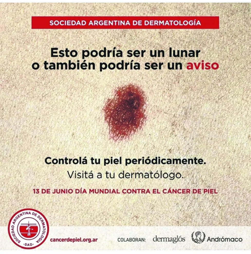 14 de Junio: "Día Mundial del Cáncer de Piel"